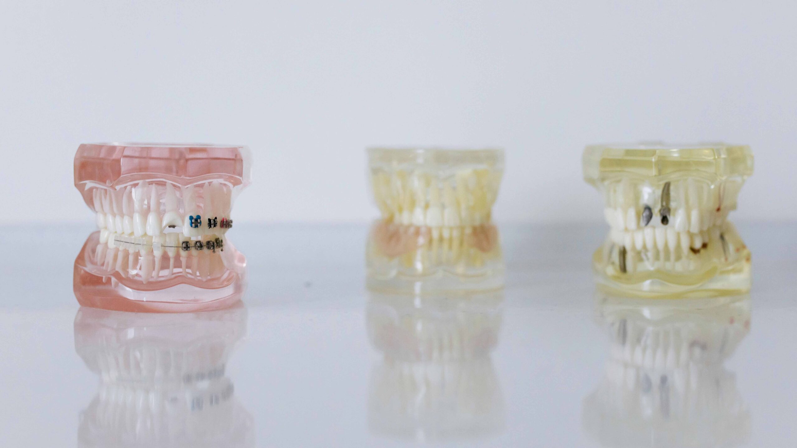 what are dental implants made of