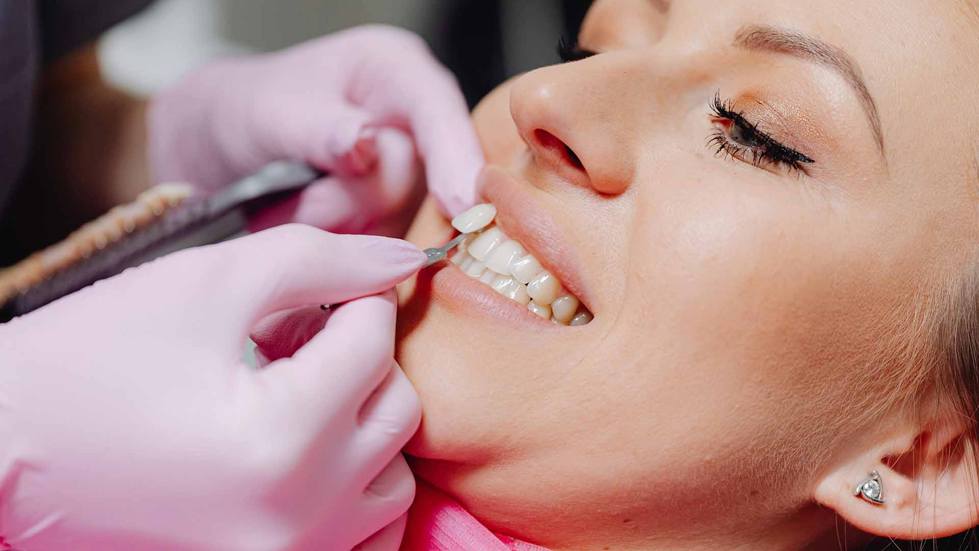 How Much Does Professional Teeth Whitening Cost at the Dentist? A Comprehensive Guide