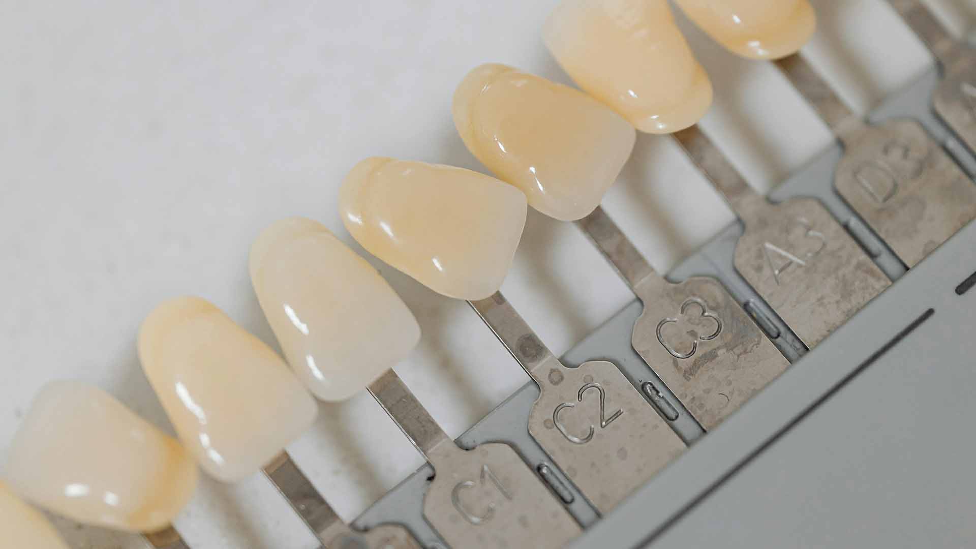 Dental Implants