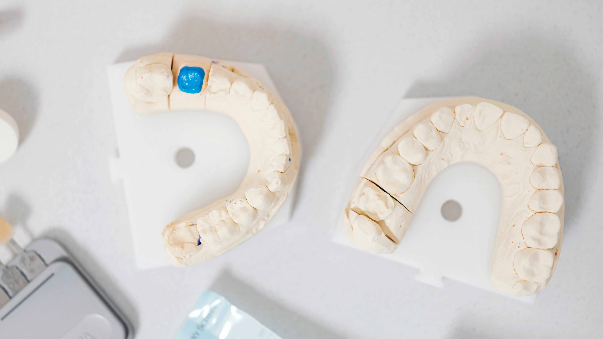 Is It Ever Too Late to Get Dental Implants? Understanding Timing, Age, and Health Considerations