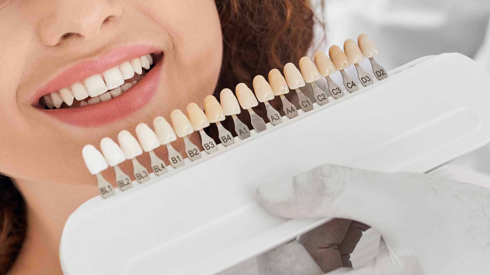 How Much Are Porcelain Veneers in NYC and New Jersey? Your Complete Guide to Pricing and Factors